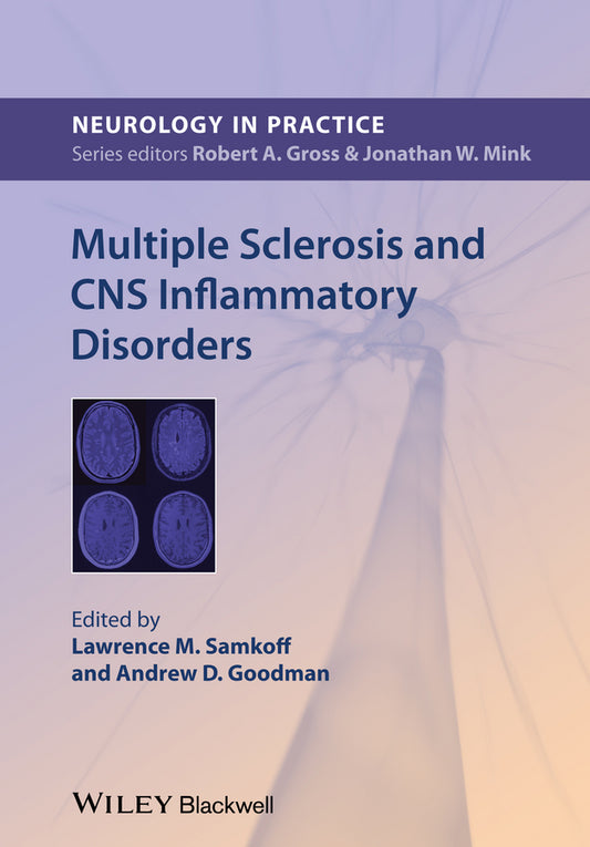 Multiple Sclerosis and CNS Inflammatory Disorders (Paperback / softback) 9780470673881