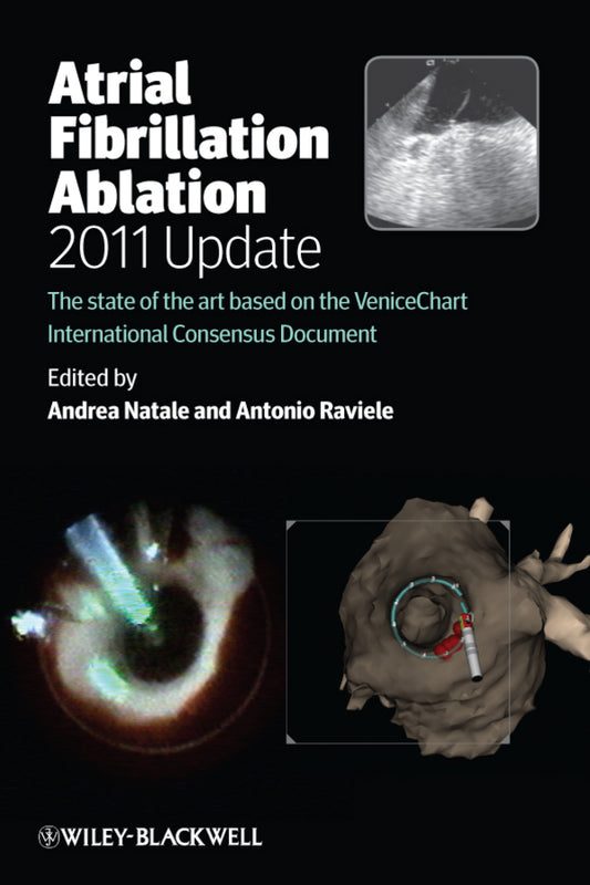 Atrial Fibrillation Ablation, 2011 Update; The State of the Art based on the VeniceChart International Consensus Document (Paperback / softback) 9780470674154