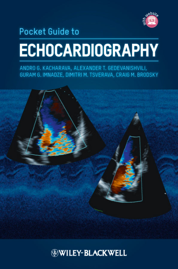 Pocket Guide to Echocardiography (Paperback / softback) 9780470674444