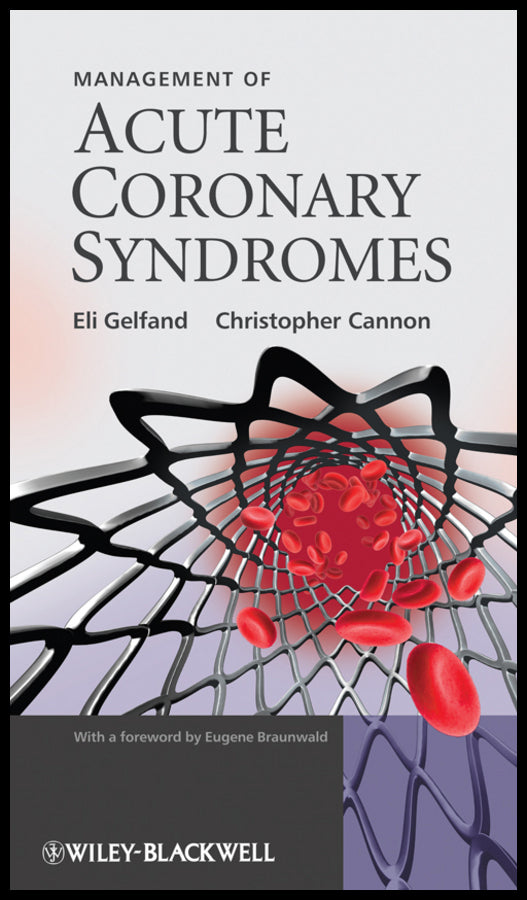 Management of Acute Coronary Syndromes (Hardback) 9780470725573