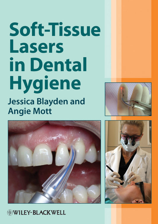 Soft-Tissue Lasers in Dental Hygiene (Paperback / softback) 9780470958544