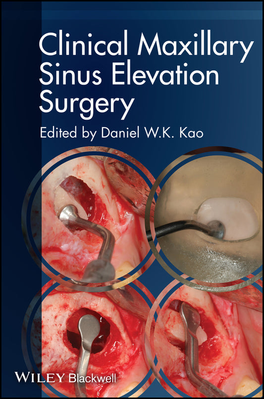 Clinical Maxillary Sinus Elevation Surgery (Paperback / softback) 9780470960738