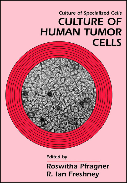 Culture of Human Tumor Cells (Paperback / softback) 9780471438533