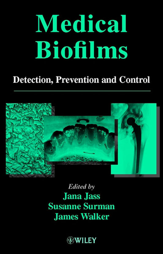 Medical Biofilms; Detection, Prevention and Control (Hardback) 9780471988670