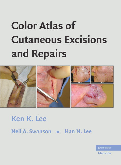 Color Atlas of Cutaneous Excisions and Repairs (Hardback) 9780521860246