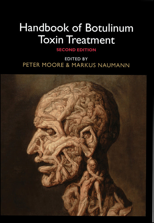 Handbook of Botulinum Toxin Treatment (Hardback) 9780632059577