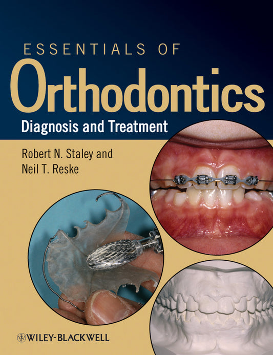 Essentials of Orthodontics; Diagnosis and Treatment (Paperback / softback) 9780813808680