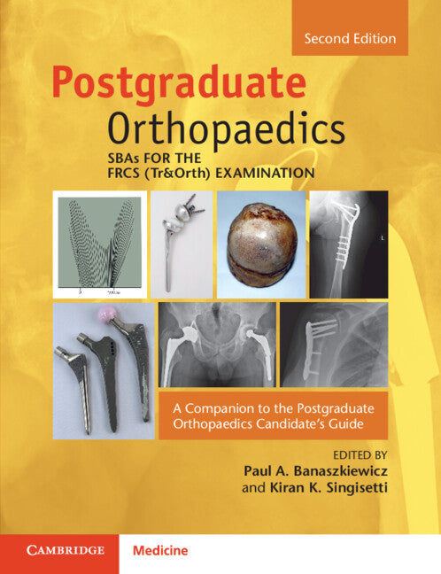 SBAs for the FRCS (Tr&Orth) Examination; A Companion to the Postgraduate Orthopaedics Candidate's Guide (Paperback / softback) 9781009287920