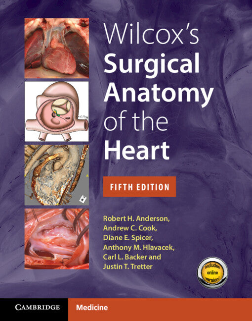 Wilcox's Surgical Anatomy of the Heart (Multiple-component retail product) 9781009387392