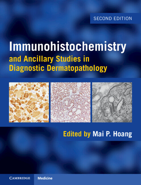 Immunohistochemistry and Ancillary Studies in Diagnostic Dermatopathology (Hardback) 9781009549226