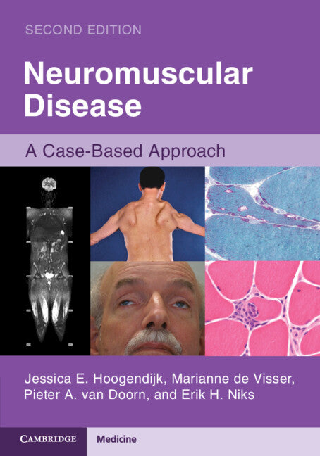 Neuromuscular Disease; A Case-Based Approach (Paperback / softback) 9781108744188