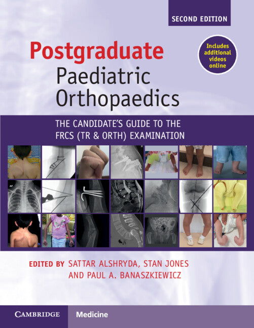 Postgraduate Paediatric Orthopaedics; The Candidate's Guide to the FRCS(Tr&Orth) Examination (Paperback / softback) 9781108970617