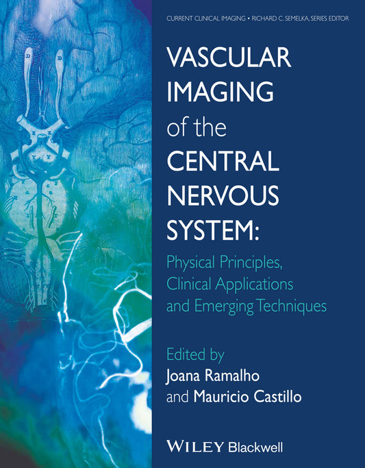 Vascular Imaging of the Central Nervous System; Physical Principles, Clinical Applications, and Emerging Techniques (Hardback) 9781118188750