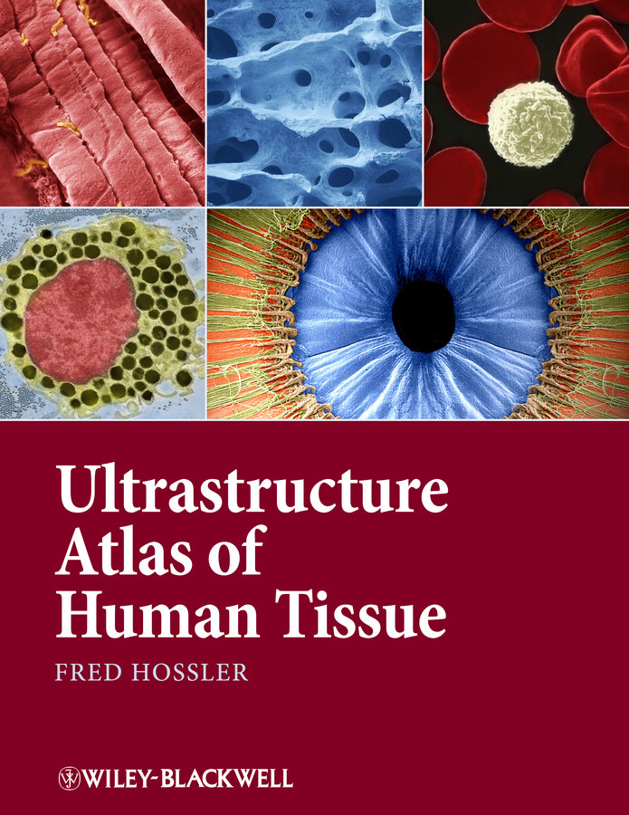 Ultrastructure Atlas of Human Tissues (Hardback) 9781118284537