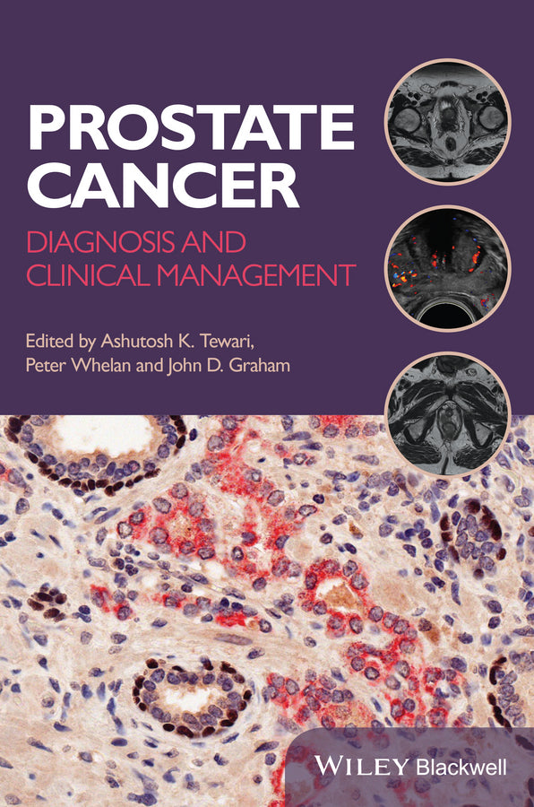 Prostate Cancer; Diagnosis and Clinical Management (Paperback / softback) 9781118347355
