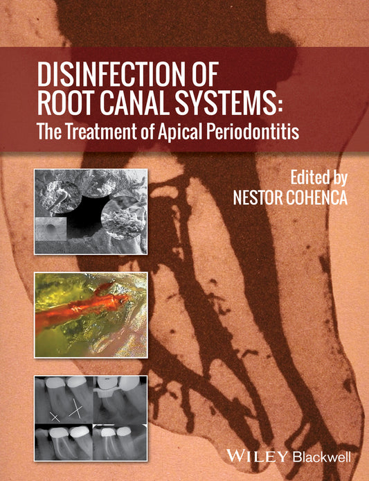 Disinfection of Root Canal Systems; The Treatment of Apical Periodontitis (Hardback) 9781118367681