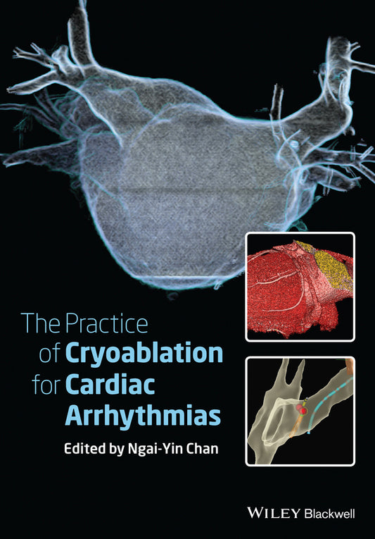 The Practice of Catheter Cryoablation for Cardiac Arrhythmias (Hardback) 9781118451830