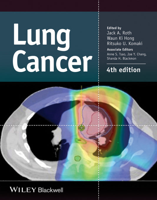 Lung Cancer (Hardback) 9781118468746