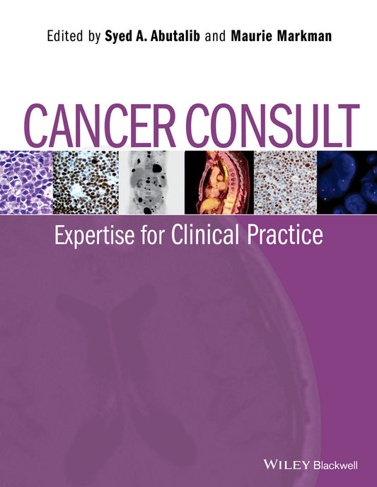 Cancer Consult; Expertise for Clinical Practice (Paperback / softback) 9781118589212