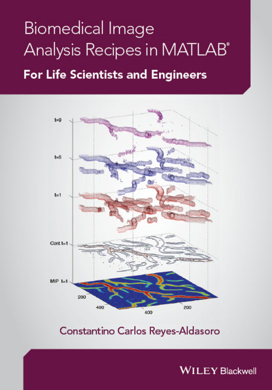 Biomedical Image Analysis Recipes in MATLAB; For Life Scientists and Engineers (Hardback) 9781118657553
