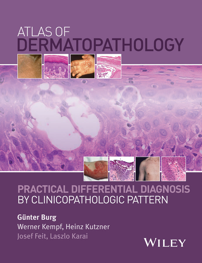 Atlas of Dermatopathology; Practical Differential Diagnosis by Clinicopathologic Pattern (Hardback) 9781118658314