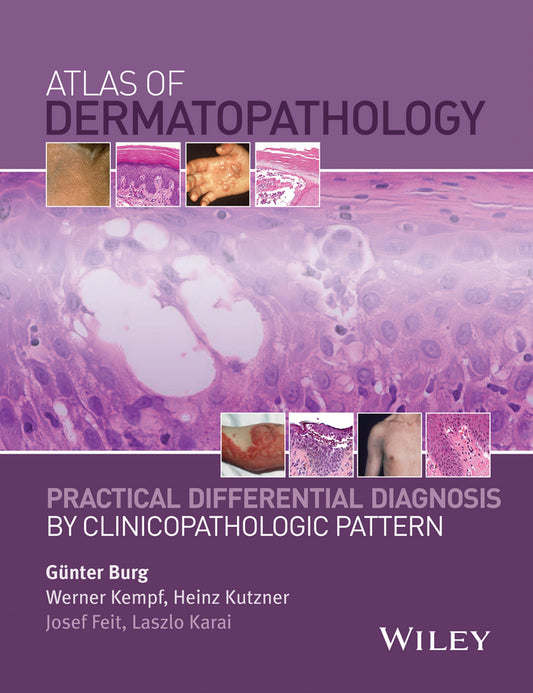 Atlas of Dermatopathology; Practical Differential Diagnosis by Clinicopathologic Pattern (Hardback) 9781118658314