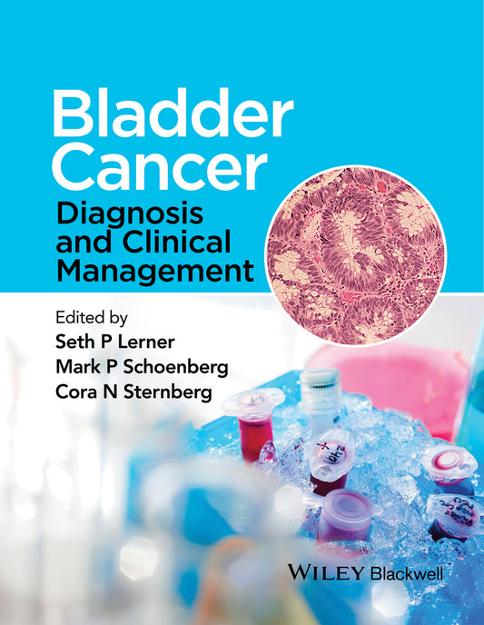 Bladder Cancer; Diagnosis and Clinical Management (Hardback) 9781118674840