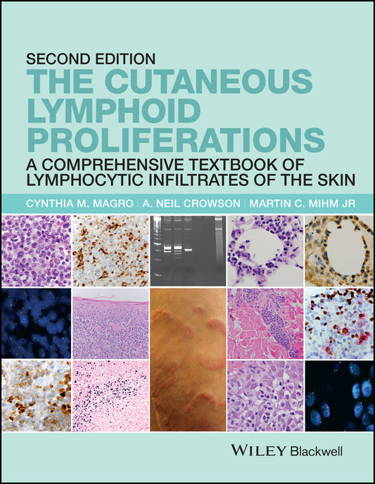 The Cutaneous Lymphoid Proliferations; A Comprehensive Textbook of Lymphocytic Infiltrates of the Skin (Hardback) 9781118776261