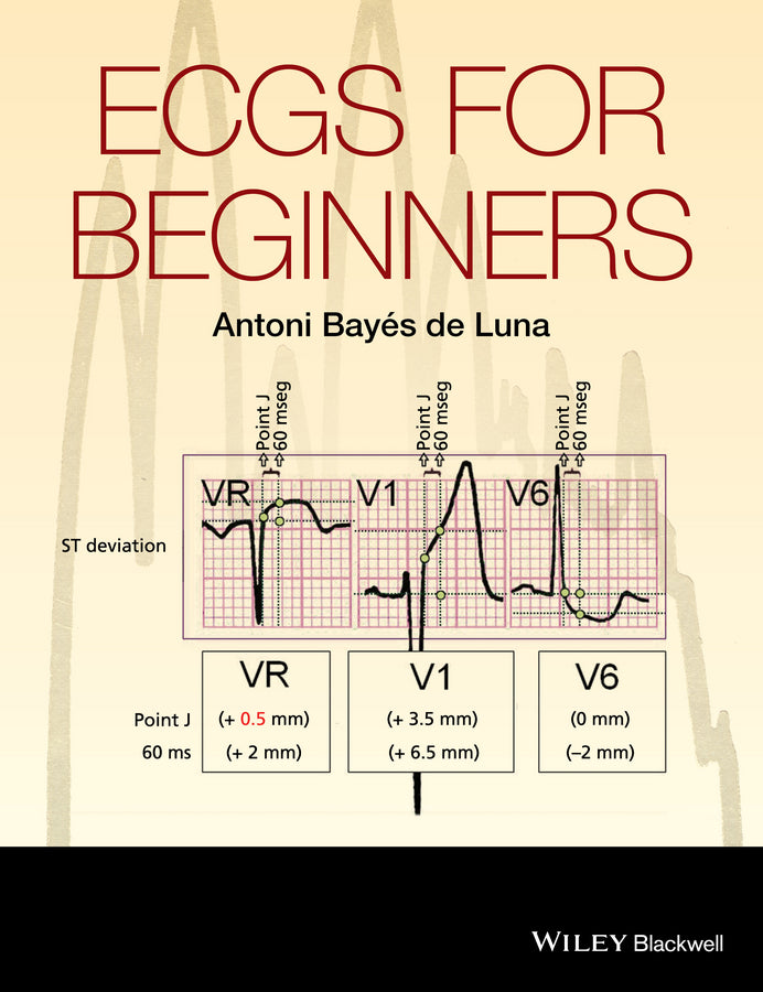 ECGs for Beginners (Paperback / softback) 9781118821312