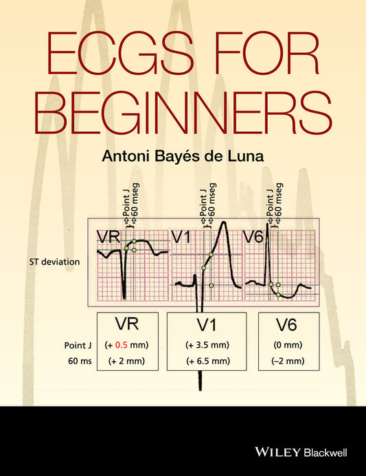 ECGs for Beginners (Paperback / softback) 9781118821312