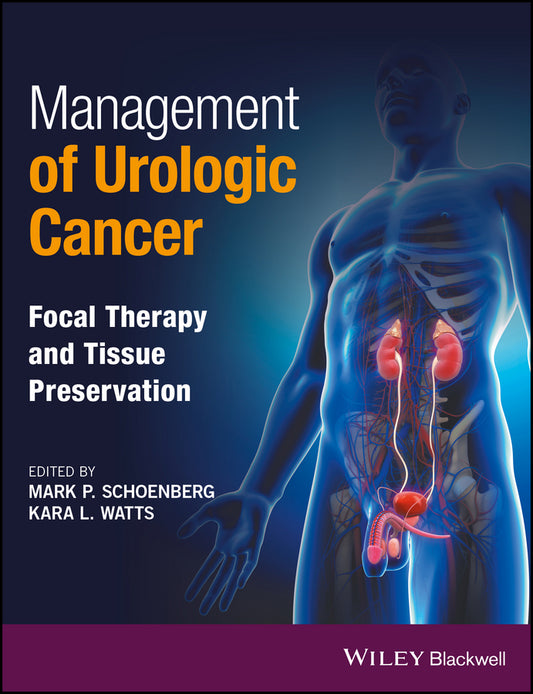 Management of Urologic Cancer; Focal Therapy and Tissue Preservation (Hardback) 9781118864623