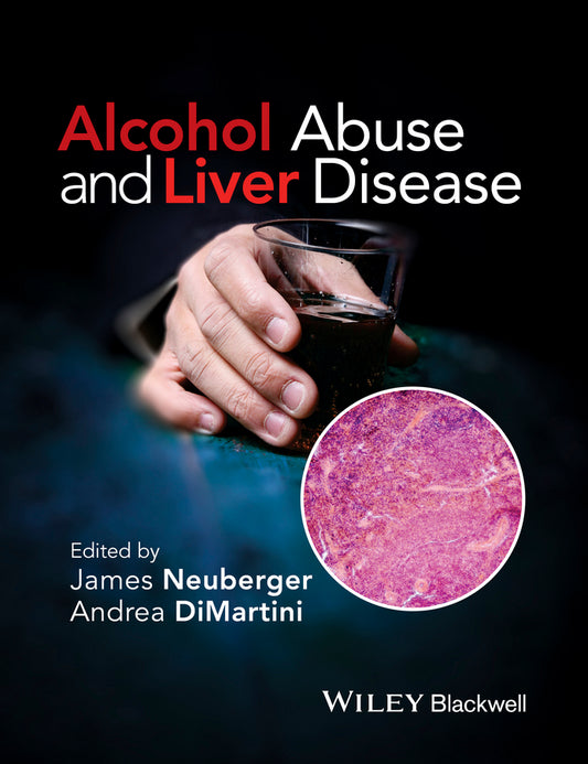 Alcohol Abuse and Liver Disease (Hardback) 9781118887288