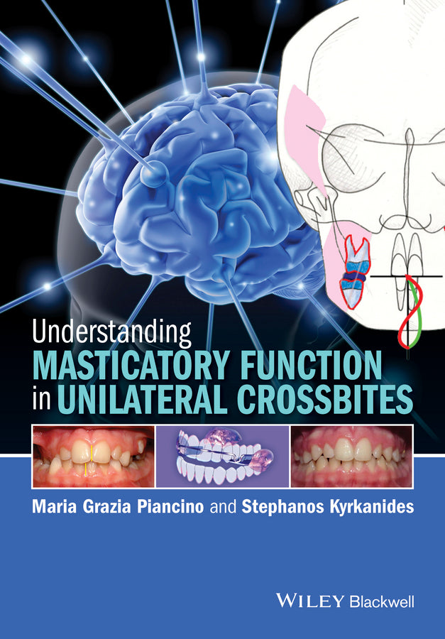 Understanding Masticatory Function in Unilateral Crossbites (Hardback) 9781118971871