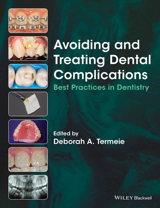 Avoiding and Treating Dental Complications; Best Practices in Dentistry (Paperback / softback) 9781118988022
