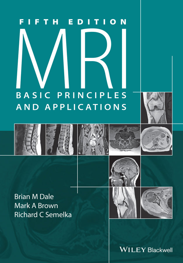 MRI; Basic Principles and Applications (Paperback / softback) 9781119013051