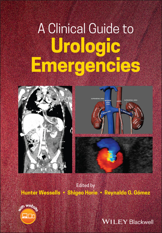 A Clinical Guide to Urologic Emergencies (Hardback) 9781119021476