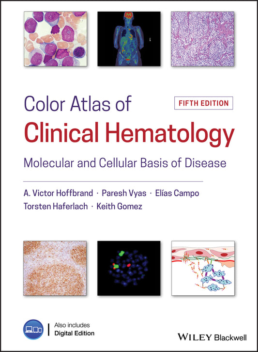 Color Atlas of Clinical Hematology; Molecular and Cellular Basis of Disease (Hardback) 9781119057017