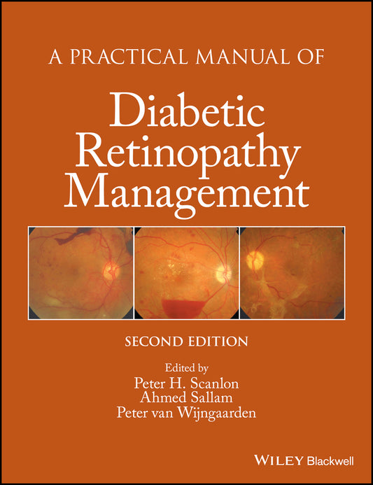 A Practical Manual of Diabetic Retinopathy Management (Hardback) 9781119058953