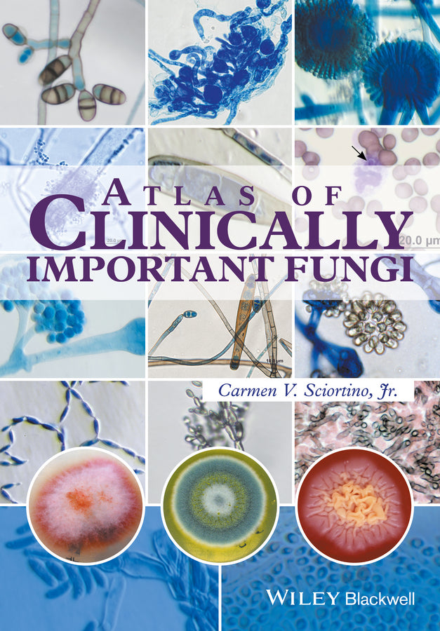 Atlas of Clinically Important Fungi (Hardback) 9781119069669