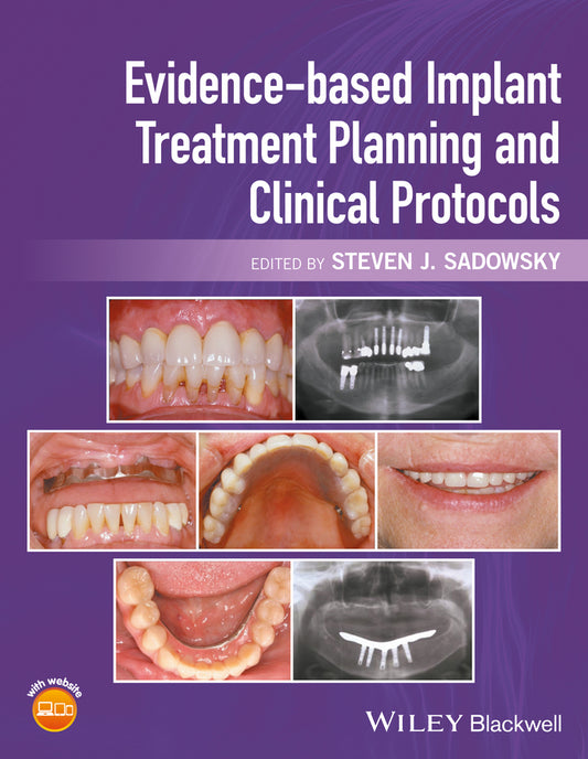 Evidence-based Implant Treatment Planning and Clinical Protocols (Hardback) 9781119080039
