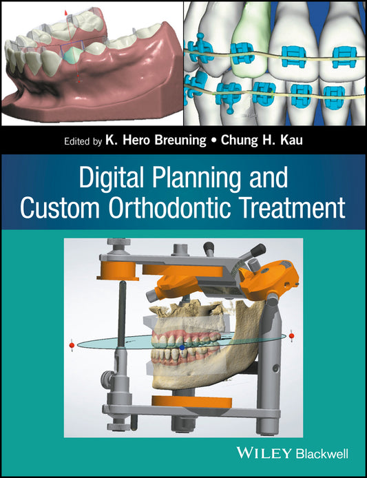 Digital Planning and Custom Orthodontic Treatment (Paperback / softback) 9781119087779