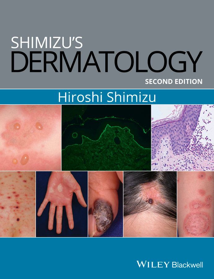 Shimizu's Dermatology (Paperback / softback) 9781119099055