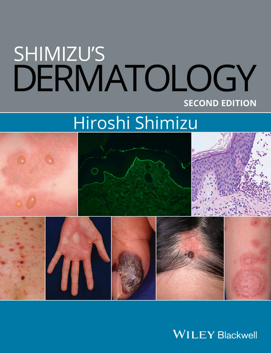 Shimizu's Dermatology (Paperback / softback) 9781119099055