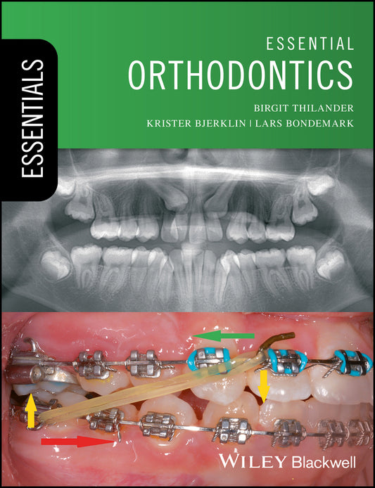 Essential Orthodontics (Paperback / softback) 9781119165675
