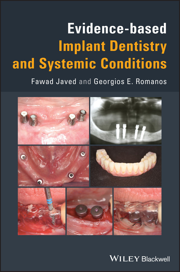 Evidence-based Implant Dentistry and Systemic Conditions (Hardback) 9781119212249