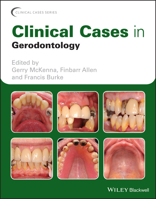 Clinical Cases in Gerodontology (Paperback / softback) 9781119226598