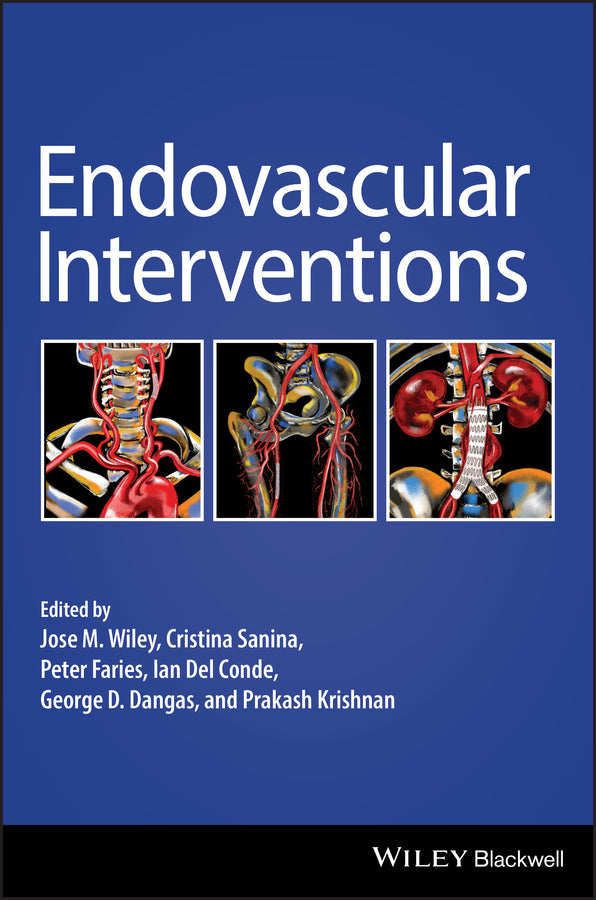 Endovascular Interventions (Hardback) 9781119283492