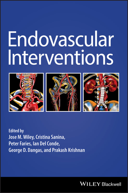Endovascular Interventions (Hardback) 9781119283492