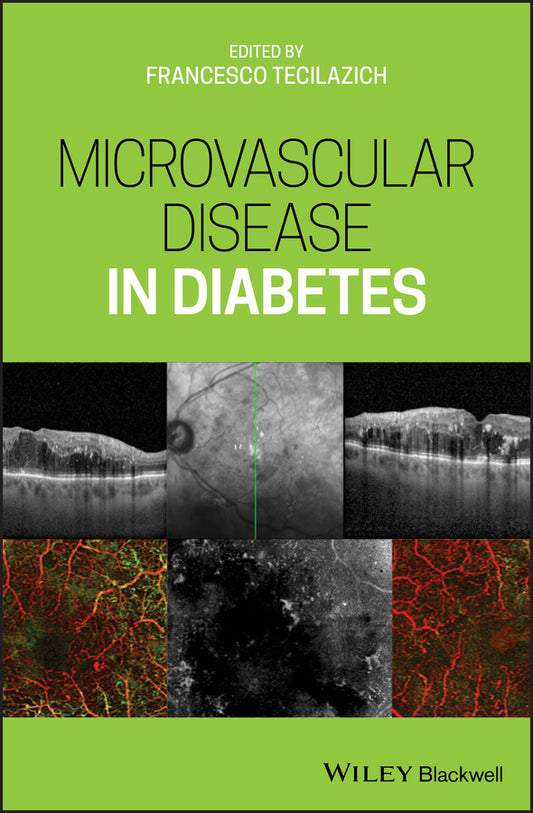 Microvascular Disease in Diabetes (Hardback) 9781119309604