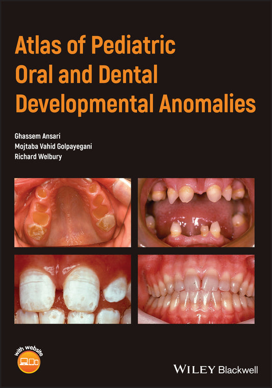 Atlas of Pediatric Oral and Dental Developmental Anomalies (Paperback / softback) 9781119380856